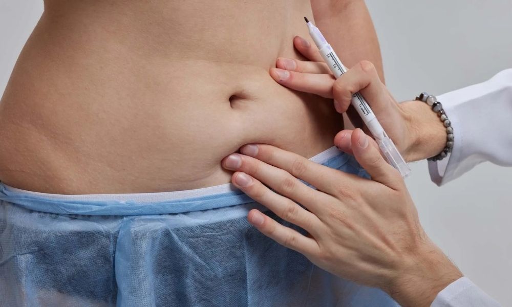 Cirugía Plástica en Clínica CleverSalud: Especialistas en Estética y Reconstrucción