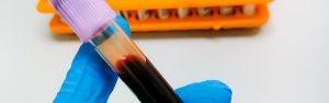 Hematología - CleverSalud